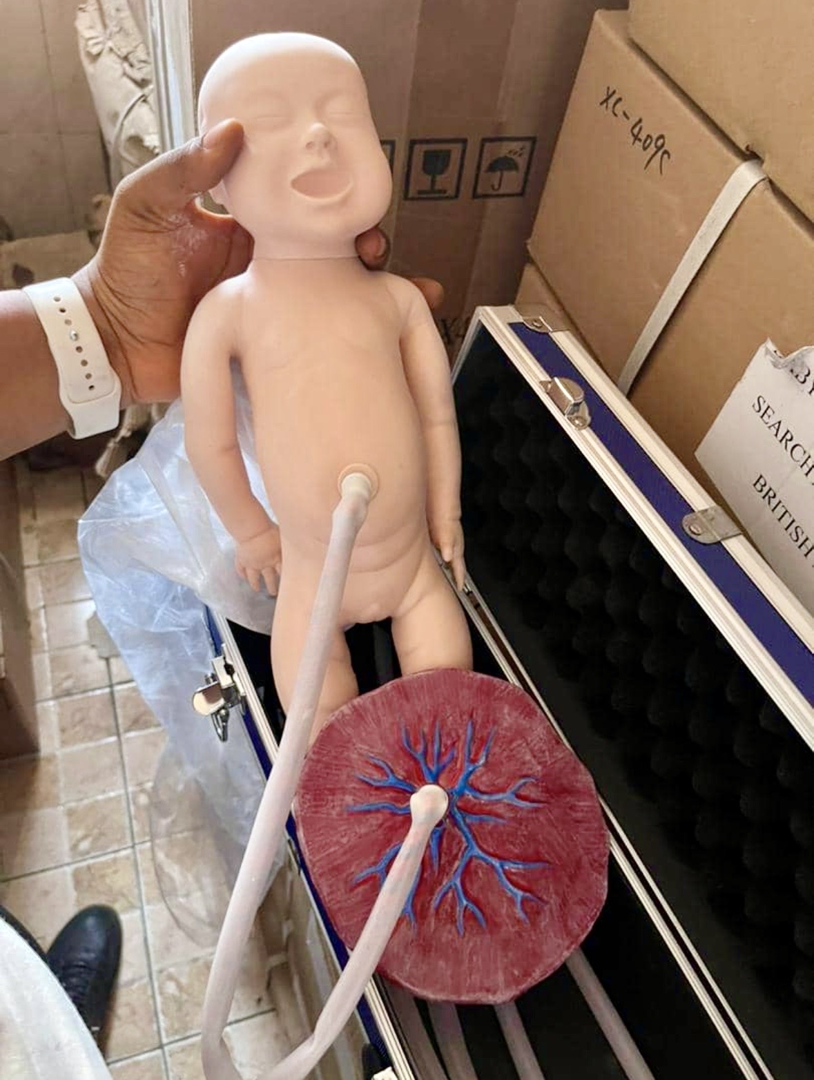 Neonatal Umbilical Cord and Placenta Model 1